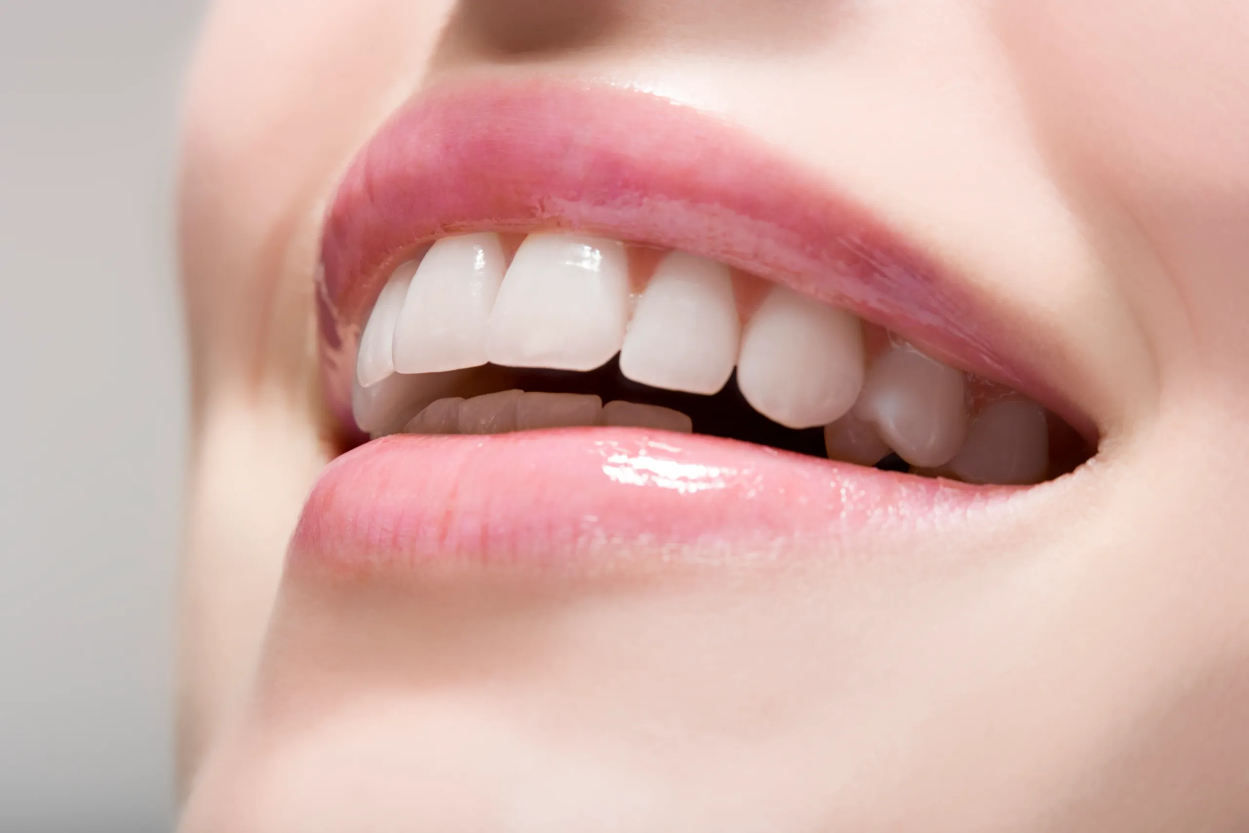 Laser Teeth Whitening FAQs Dagenham