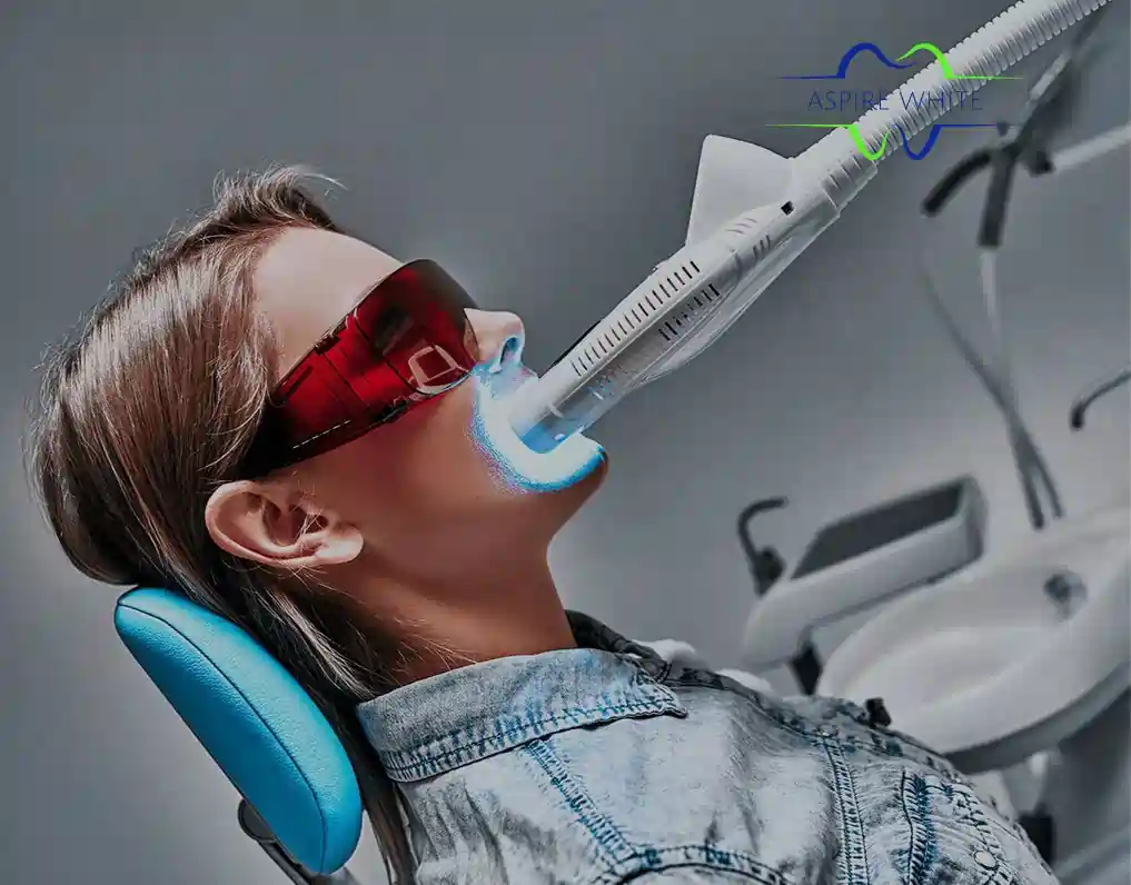 1 Hour Teeth Whitening with Aspire White Dagenham