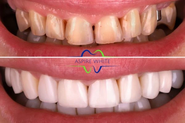Before And After Results Dagenham